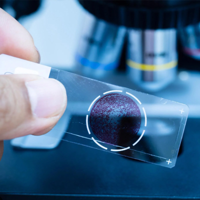 Pathology Testing